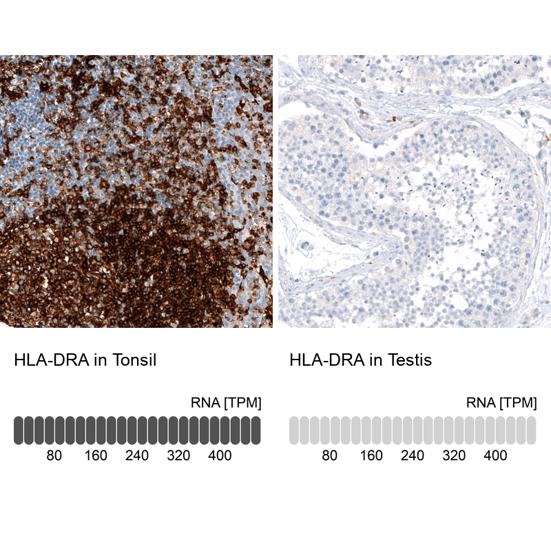 Atlas Antibodies Anti-HLA-DRA Antibody