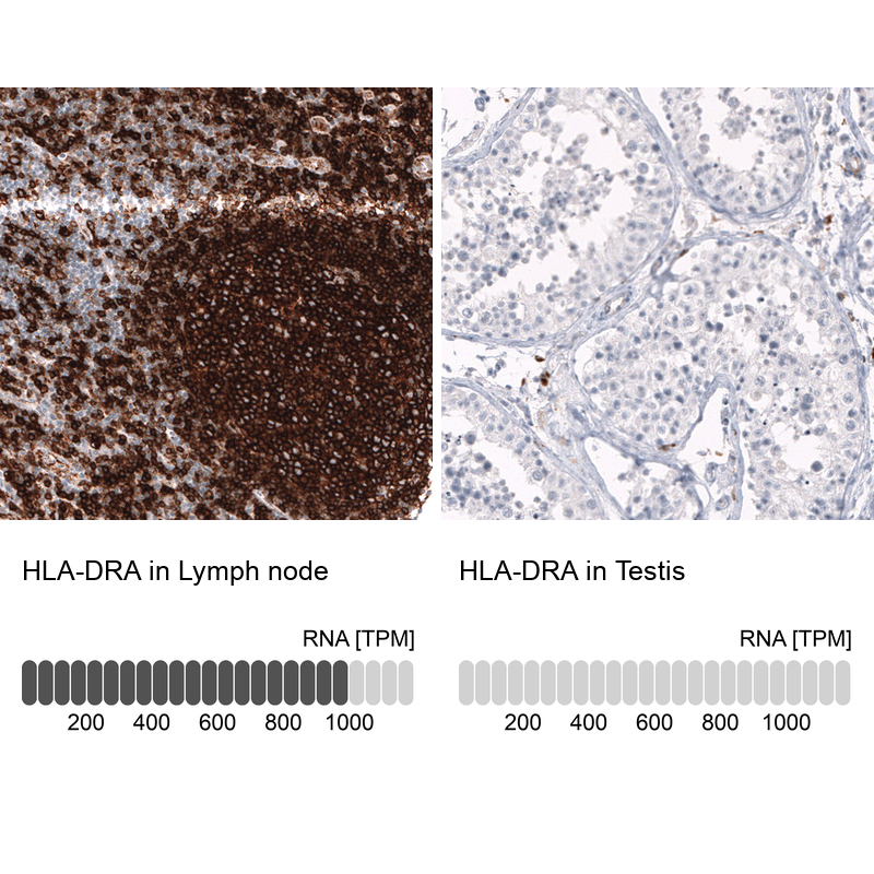 Atlas Antibodies Anti-HLA-DRA Antibody