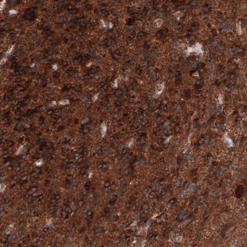 Atlas Antibodies Anti-ID1 Antibody