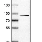 Atlas Antibodies Anti-IL17RA Antibody