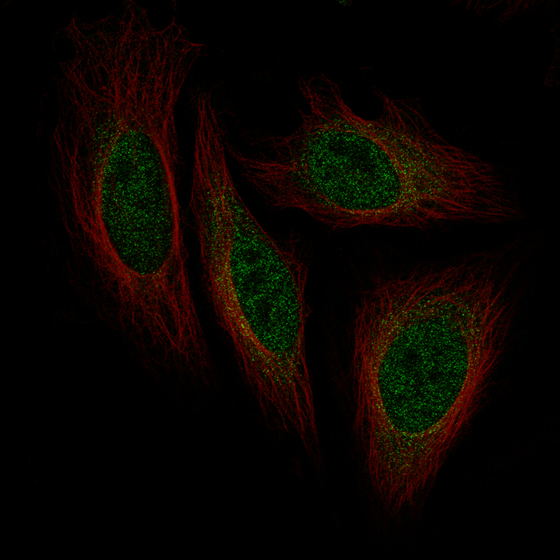 Atlas Antibodies Anti-ISL1 Antibody