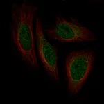 Atlas Antibodies Anti-ISL1 Antibody