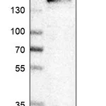 Atlas Antibodies Anti-ITGA4 Antibody