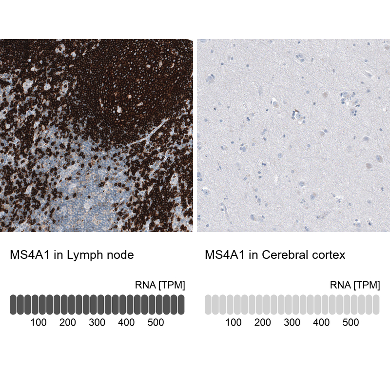 Atlas Antibodies Anti-MS4A1 Antibody