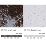 Atlas Antibodies Anti-MS4A1 Antibody