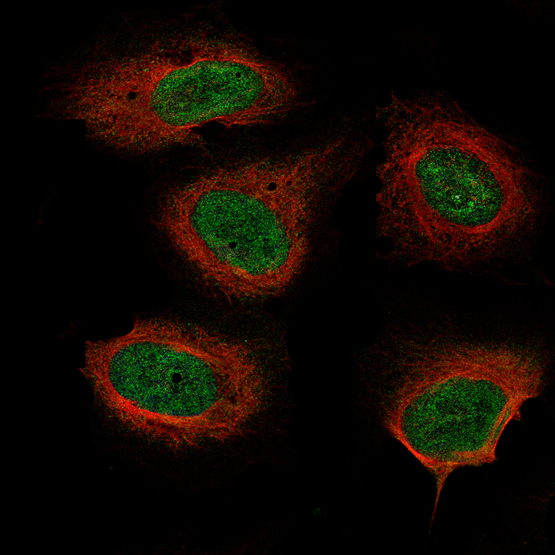 Atlas Antibodies Anti-NF1 Antibody
