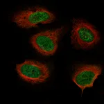 Atlas Antibodies Anti-NF1 Antibody