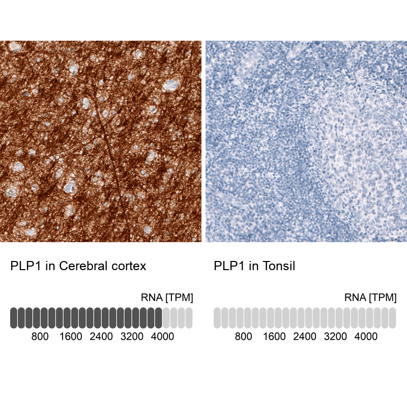 Atlas Antibodies Anti-PLP1 Antibody
