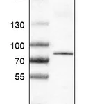 Atlas Antibodies Anti-RIPK1 Antibody