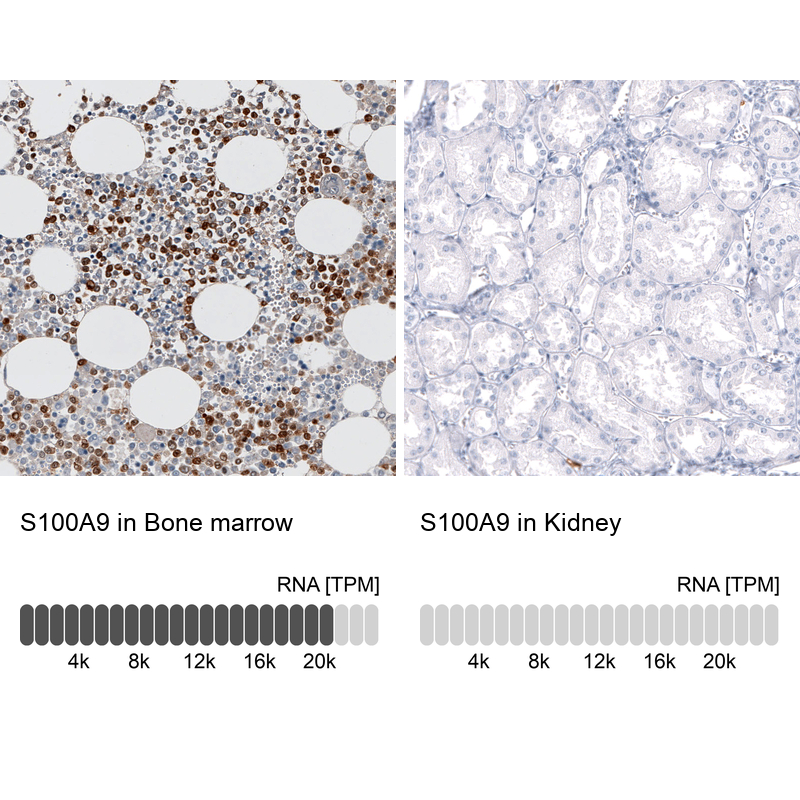 Atlas Antibodies Anti-S100A9 Antibody