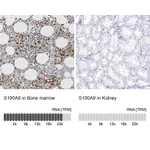 Atlas Antibodies Anti-S100A9 Antibody