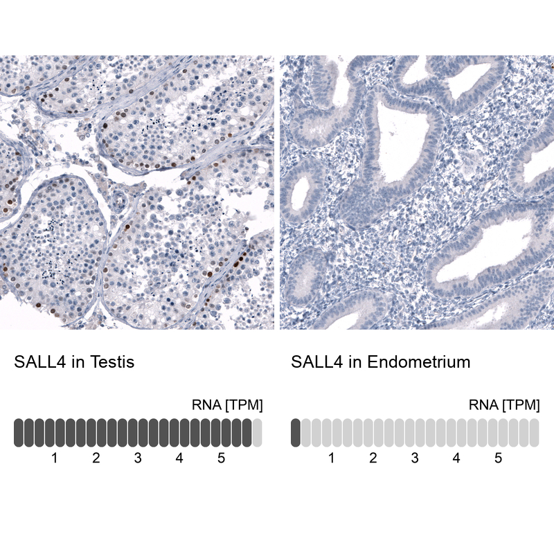 Atlas Antibodies Anti-SALL4 Antibody