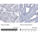Atlas Antibodies Anti-SALL4 Antibody