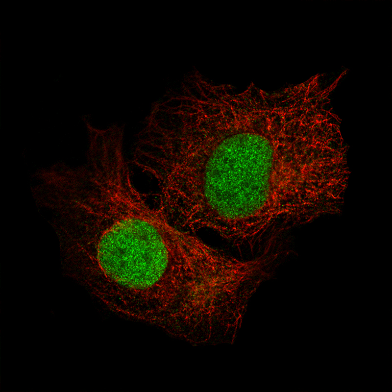 Atlas Antibodies Anti-SALL4 Antibody