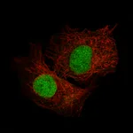 Atlas Antibodies Anti-SALL4 Antibody