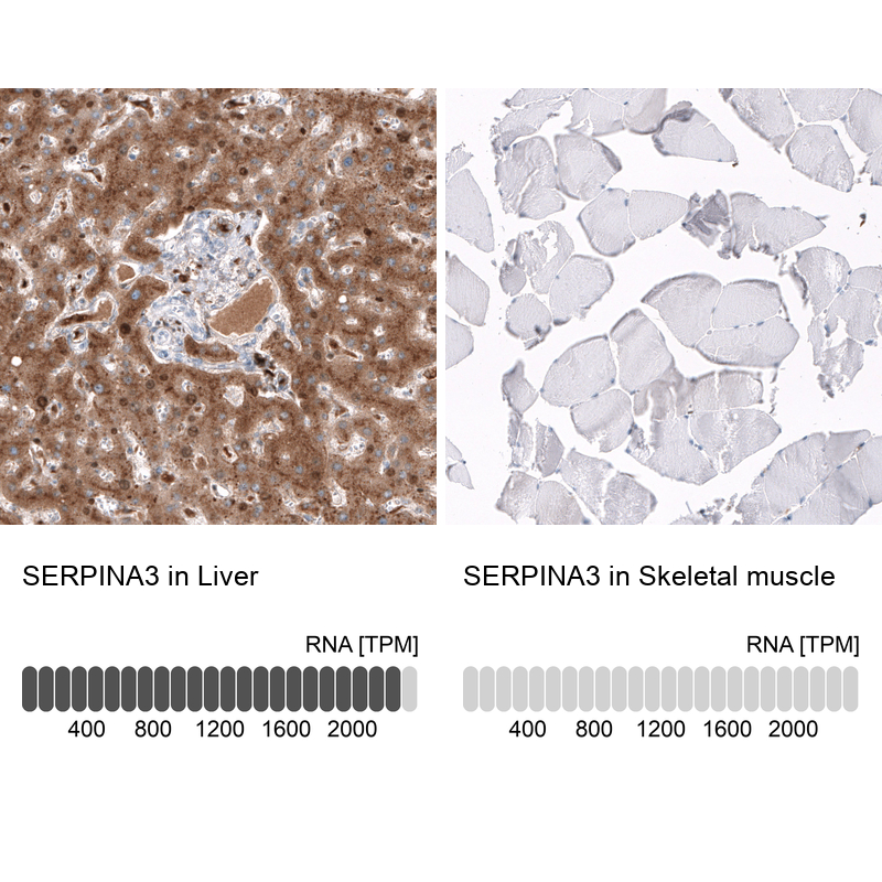 Atlas Antibodies Anti-SERPINA3 Antibody