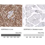 Atlas Antibodies Anti-SERPINA3 Antibody