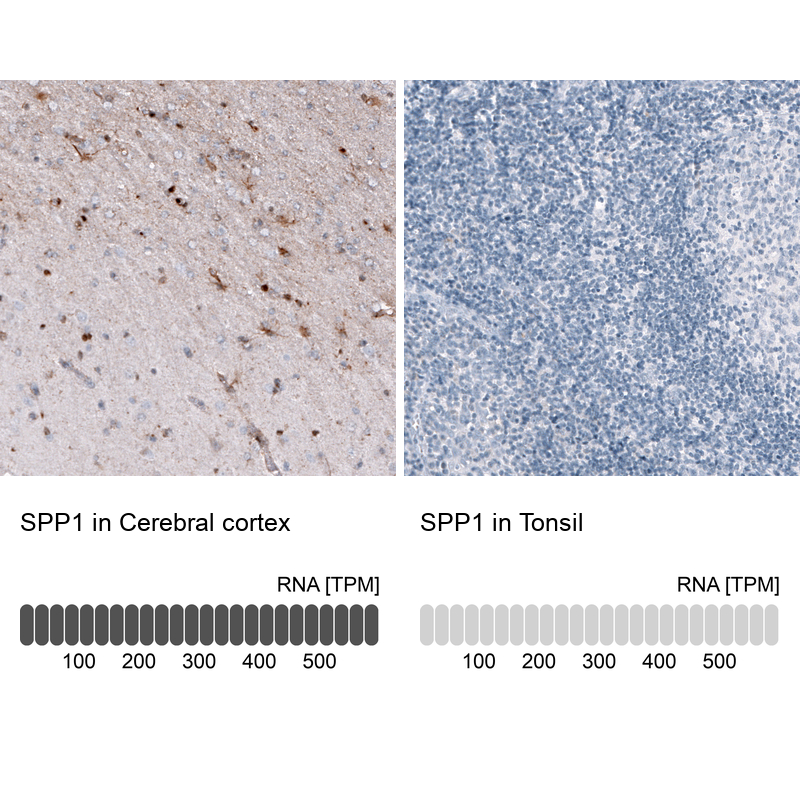 Atlas Antibodies Anti-SPP1 Antibody