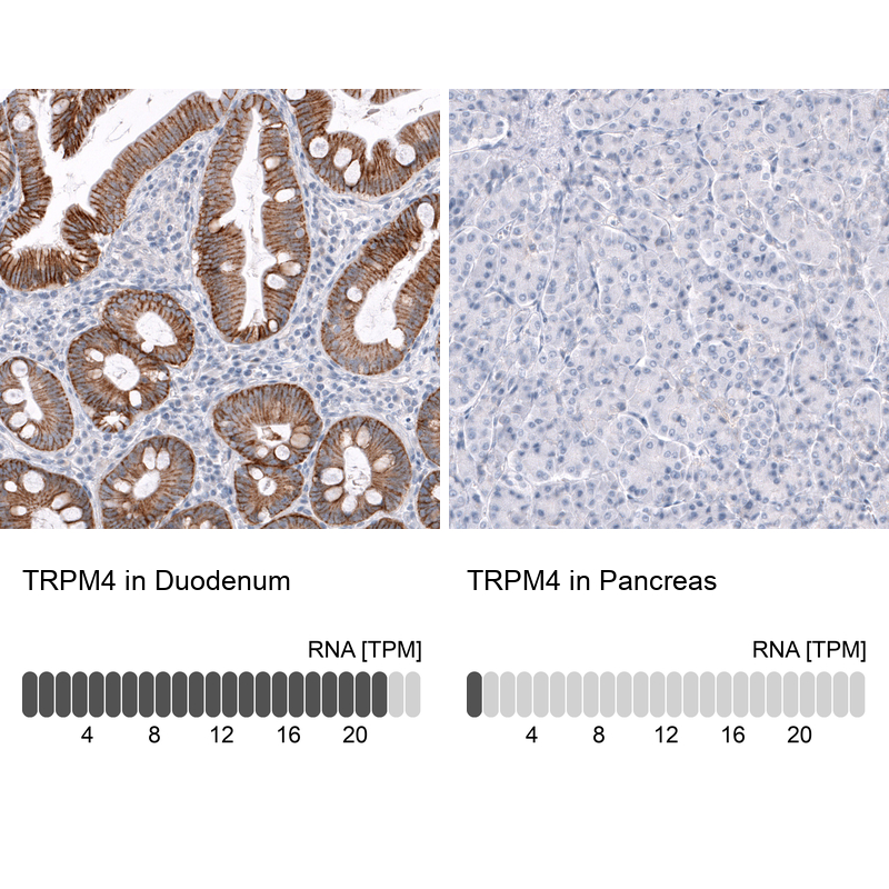 Atlas Antibodies Anti-TRPM4 Antibody