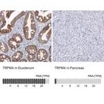 Atlas Antibodies Anti-TRPM4 Antibody