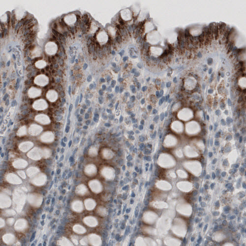 Atlas Antibodies Anti-ACAA1 Antibody