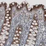 Atlas Antibodies Anti-ACAA1 Antibody