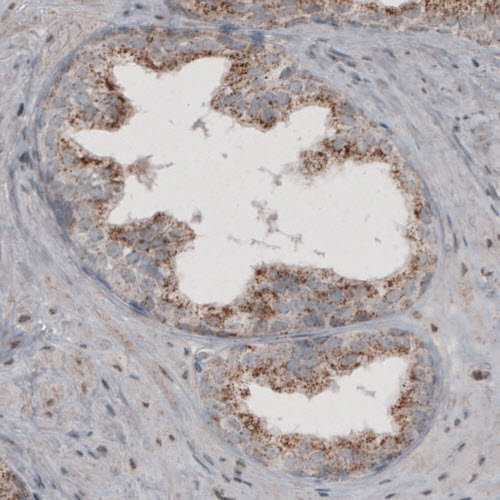 Atlas Antibodies Anti-ACAA1 Antibody