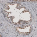 Atlas Antibodies Anti-ACAA1 Antibody