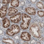 Atlas Antibodies Anti-ACAA1 Antibody