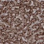 Atlas Antibodies Anti-ACAA1 Antibody