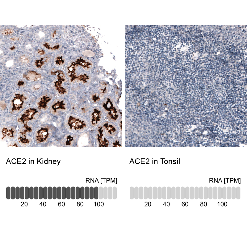Atlas Antibodies Anti-ACE2 Antibody