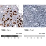 Atlas Antibodies Anti-ACE2 Antibody