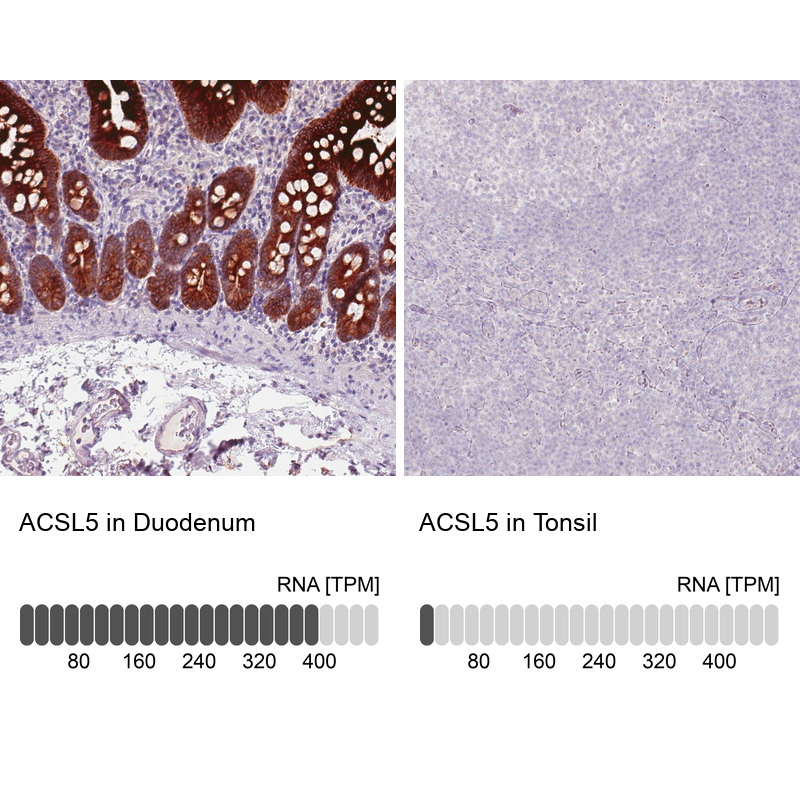 Atlas Antibodies Anti-ACSL5 Antibody