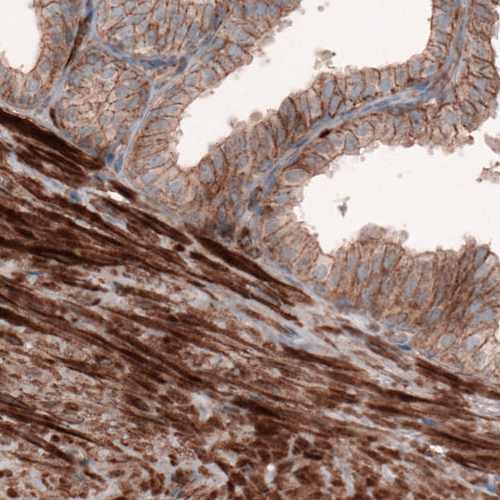Atlas Antibodies Anti-ACTB Antibody