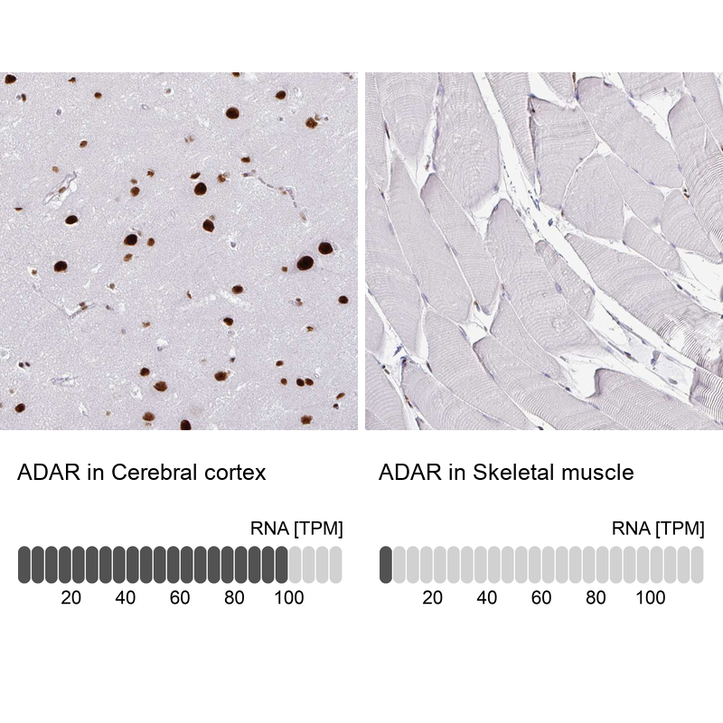 Atlas Antibodies Anti-ADAR Antibody