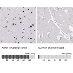 Atlas Antibodies Anti-ADAR Antibody
