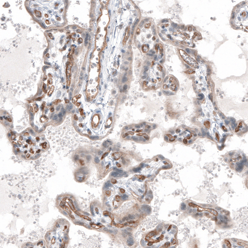 Atlas Antibodies Anti-ADGRL4 Antibody