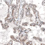 Atlas Antibodies Anti-ADGRL4 Antibody