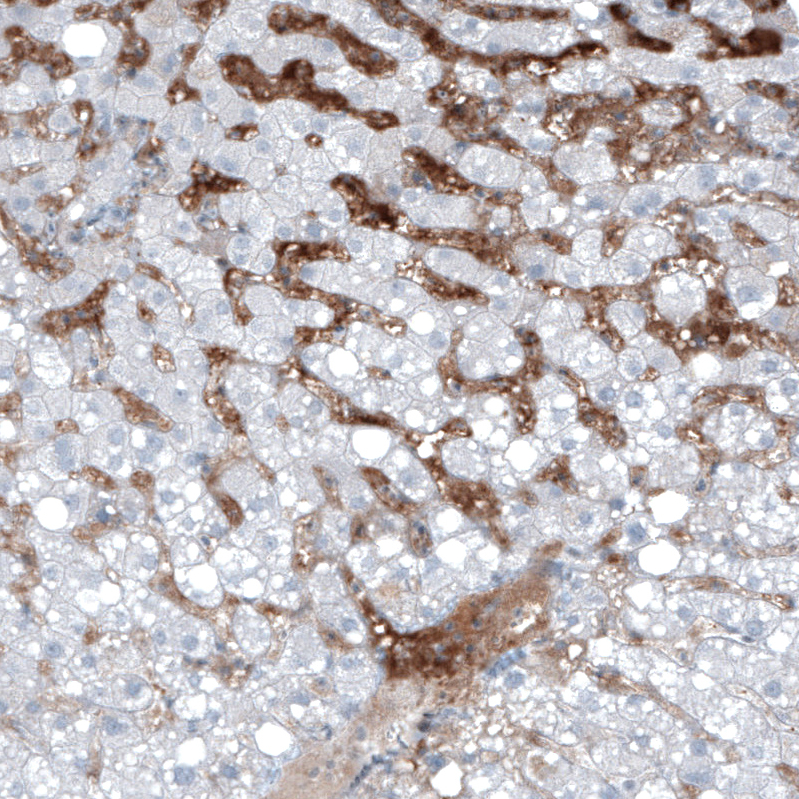 Atlas Antibodies Anti-AFP Antibody