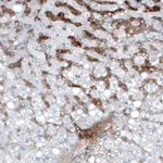 Atlas Antibodies Anti-AFP Antibody