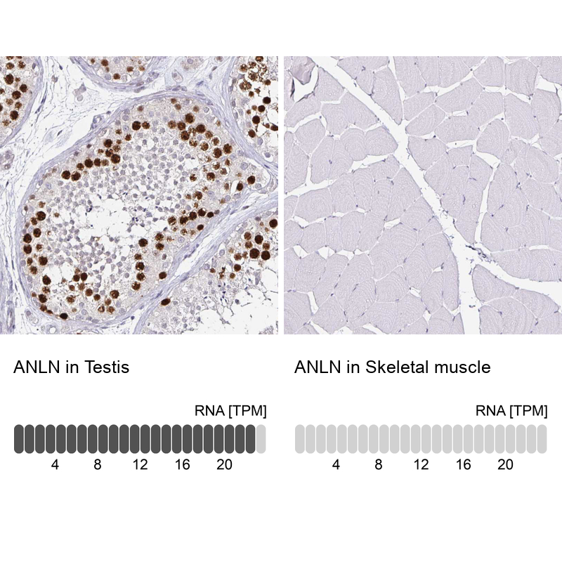 Atlas Antibodies Anti-ANLN Antibody