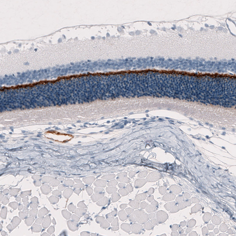 Atlas Antibodies Anti-ANO2 Antibody