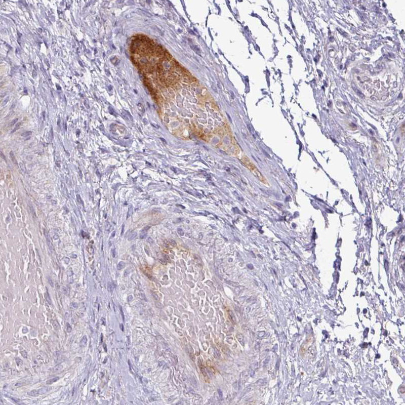 Atlas Antibodies Anti-APOL1 Antibody