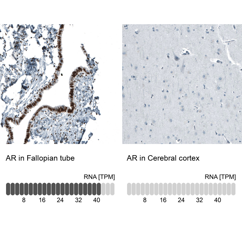 Atlas Antibodies Anti-AR Antibody