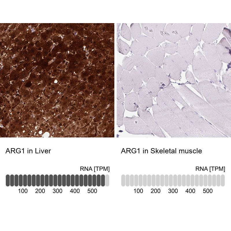 Atlas Antibodies Anti-ARG1 Antibody