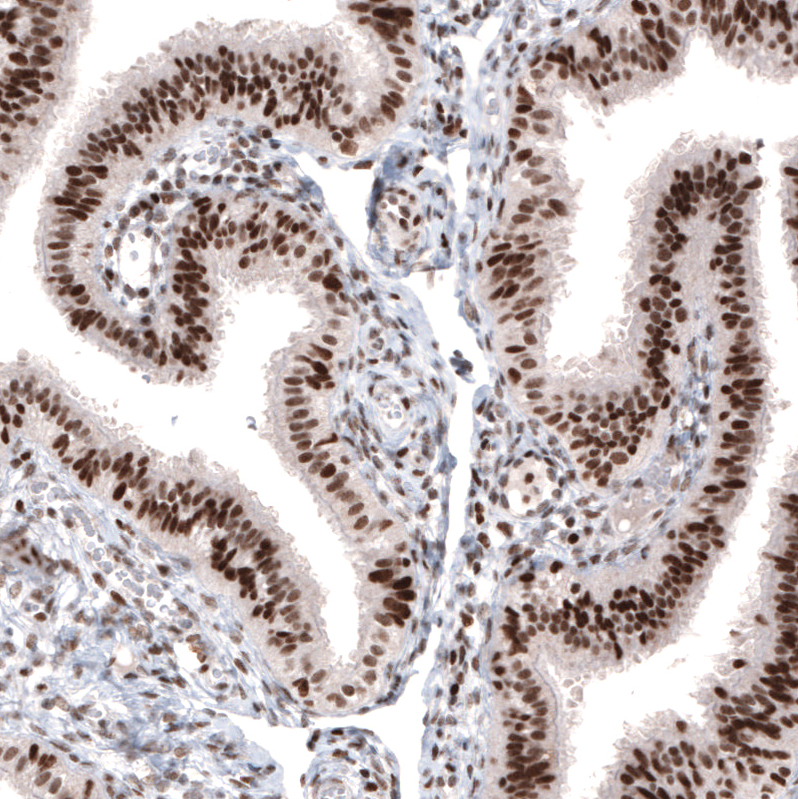 Atlas Antibodies Anti-ARID1A Antibody