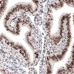 Atlas Antibodies Anti-ARID1A Antibody
