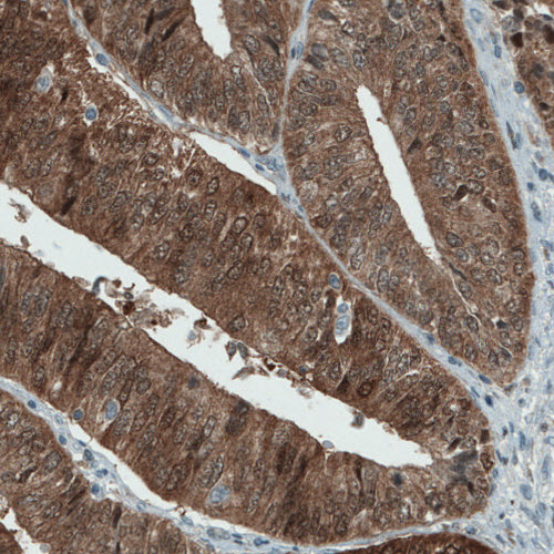 Atlas Antibodies Anti-ASRGL1 Antibody