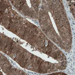 Atlas Antibodies Anti-ASRGL1 Antibody