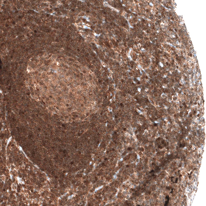 Atlas Antibodies Anti-BAX Antibody